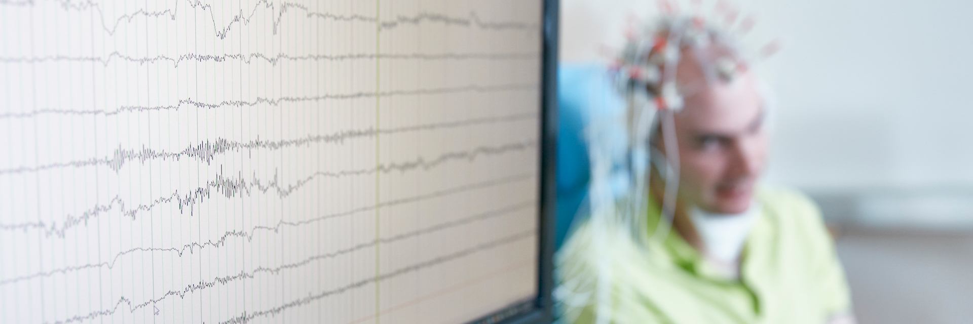 Bild: Bei einem Patienten wird ein Elektroenzephalogramm (EEG) zur Überprüfung der medikamentösen Epilepsieeinstellung erstellt